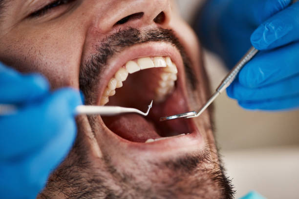 Emergency Dental Services in Bellmead, TX